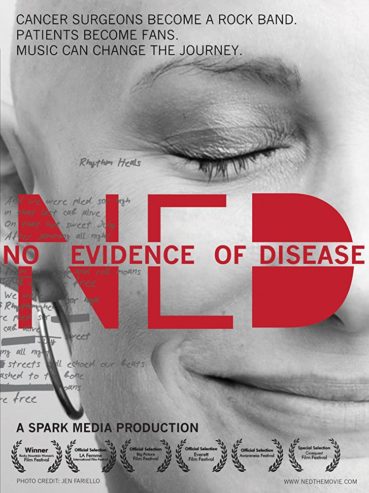 No Evidence of Disease